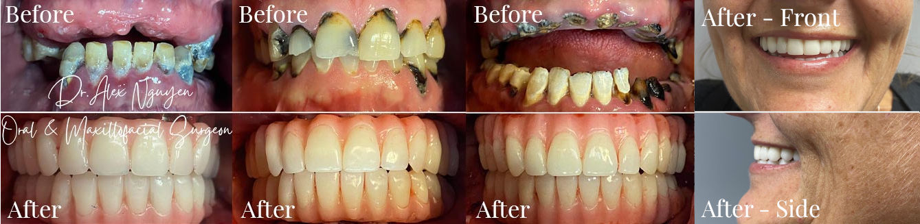 Before and After photos