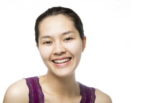 Pretty Asian woman with overbite smiling after making an appointment for treatment at Surprise Oral & Implant Surgery in Surprise, AZ.