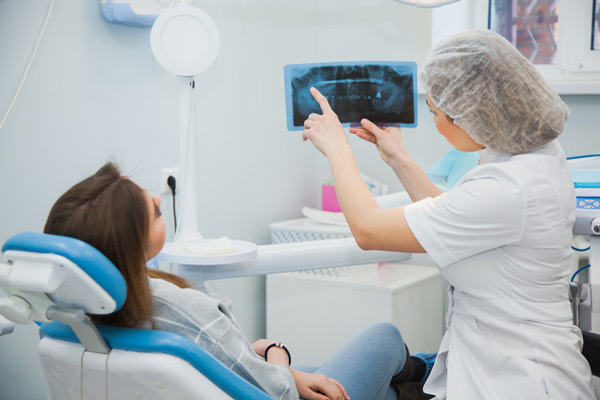 X-ray image of bone grafting at Surprise Oral & Implant Surgery.